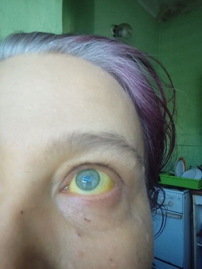 Fotografie Eva Fischerová: Abychom vinou mého zdravotního stavu a nedoplatku nepřišli o domov