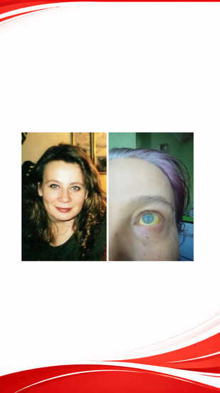 Foto k příběhu Eva Fischerová: Abychom vinou mého zdravotního stavu a nedoplatku nepřišli o domov