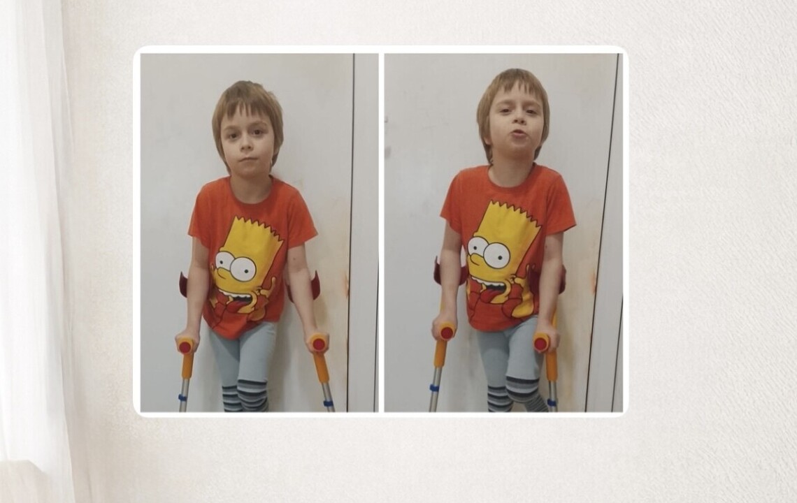 Fotografie Michaela Kočí: Od onemocnění kyčle Matyáška se nám vše hroutí...